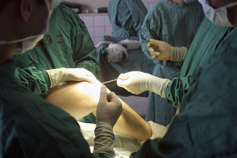 A leg lengthening operation in Beijing, China, in August 2003.
